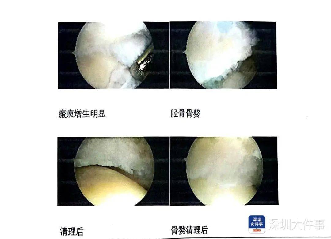 “一走路就痛”！女子脚踝受伤遭漏诊<strong></p>
<p>金融经济</strong>，治了7年没好！深圳一医院被告上法庭
