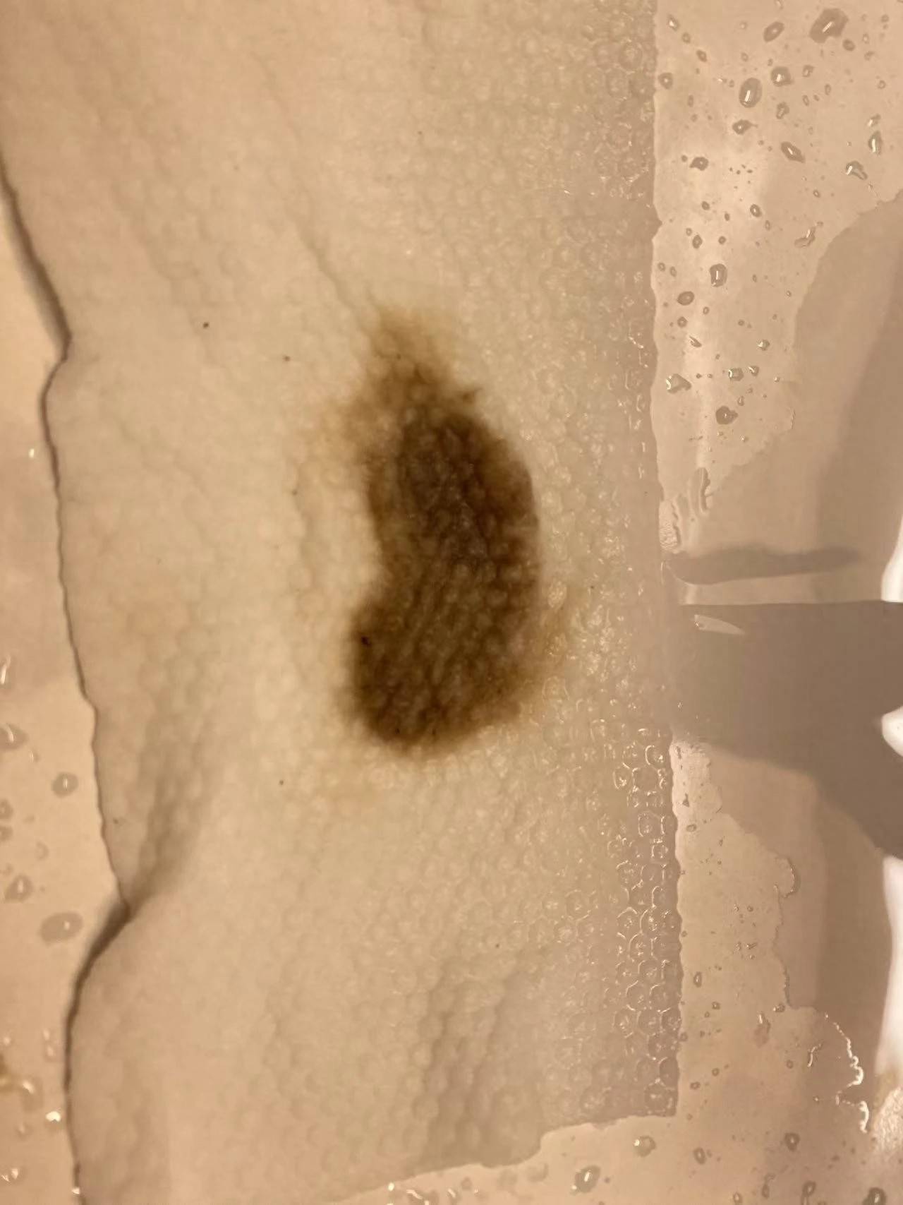 杭州部分小区居民反映自来水发臭<strong></p>
<p>买入返售金融资产</strong>,污染源仍不明