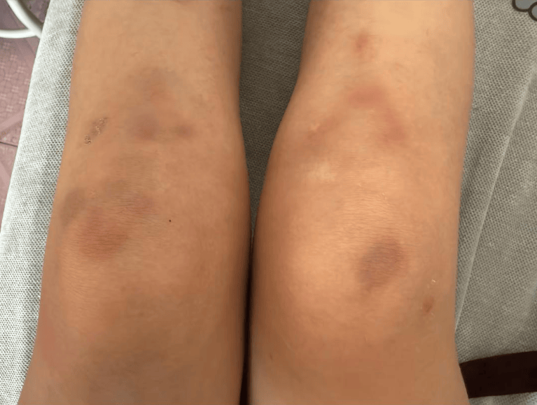 女子自称因工资问题被老板锁办公室里打 警方:双方已到派出所<strong></p>
<p>如何选股票</strong>,是否打人还在调查