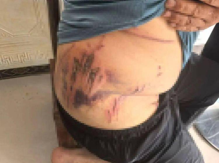 湖北鹤峰县疑再现老虎踪迹<strong></p>
<p>紫金矿业股票</strong>,村民家猪遭袭,玉米地发现脚印,此前男子自称干农活时被抓伤,当地回应