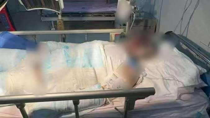 父子在哈尔滨一亲戚公司上班遇爆炸全身烧伤<strong></p>
<p>方正科技股票</strong>，治疗花费近百万公司拒赔偿？亲戚回应