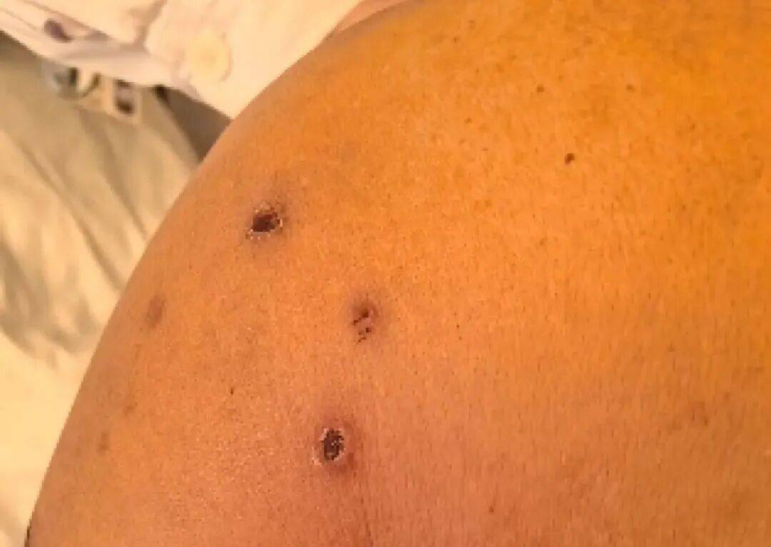 深圳一市民突遭马蜂围袭!已进入高发期<strong></p>
<p>方正科技股票</strong>,千万别招惹!