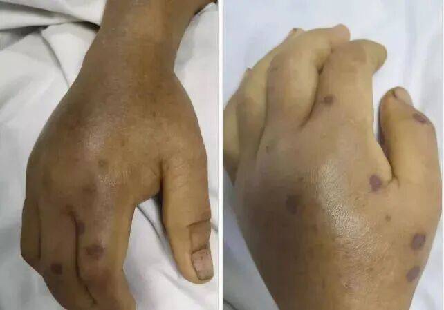 深圳一市民突遭马蜂围袭!已进入高发期<strong></p>
<p>方正科技股票</strong>,千万别招惹!