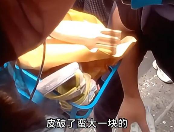 看着都疼<strong></p>
<p>京东股票</strong>!上海街头一男子突然求助:10岁女儿被死死卡住!这个行为太危险→
